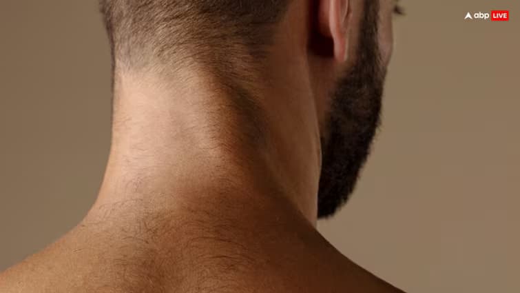 lifestyle beauty black neck solution use this thing for white neck within few days read article in Gujarati Beauty Tips : તમારી ગરદનને સફેદ કરવા માટે કરો આ વસ્તુઓનો ઉપયોગ, થોડા દિવસોમાં જ તેની અસર દેખાશે.
