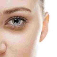 Dark Circles : ਜਾਣੋ ਕਿਹੜੀਆਂ ਆਦਤਾਂ ਹੋ ਸਕਦੀਆਂ ਹਨ ਡਾਰਕ ਸਰਕਲ ਦਾ ਕਾਰਣ