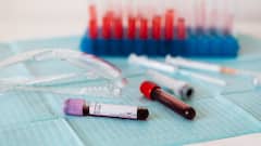 World Blood Donor Day 2024: Surprising Health Benefits Of Donating Blood