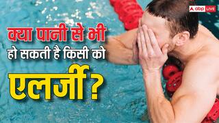 Water Allergy: क्या किसी को पानी से भी हो सकती है एलर्जी, हैरान कर देगा इसका जवाब