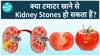 हर चीज़ में टमाटर खातें है तो होजाएं सावधानम हो सकता है Kidney Stone | Health Live