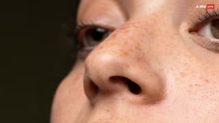 Open Pores Solution: આ 5 વસ્તુઓ ખુલ્લા છિદ્રોને ઘટાડવામાં મદદ કરશે, તમારો ચહેરો પણ ચમકવા લાગશે