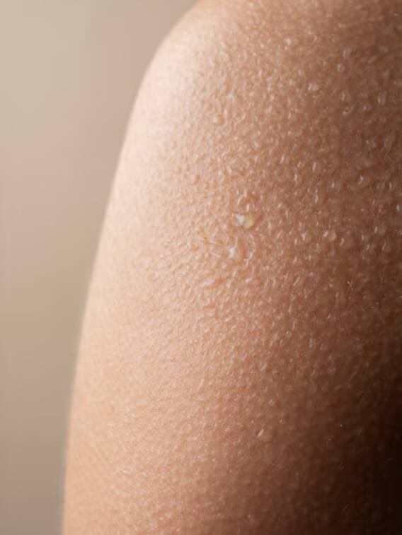 हमारे रोंगटे खड़े क्यों होते हैं?