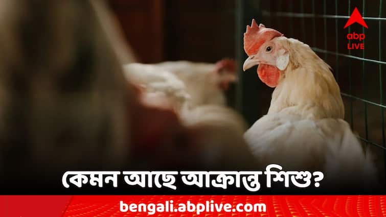 West Bengal Malda Bird Flu respiratory problems of the child is still their Bird Flu: শ্বাসকষ্টজনিত সমস্যা মেটেনি বার্ড ফ্লু আক্রান্ত শিশুর, দাবি পরিবারের