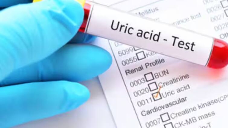 uric-acid-is-a-chemical-created-when-the-body-breaks-down-substances-called-purines Uric Acid: ਯੂਰਿਕ ਐਸਿਡ ਵਧਣ ਤੋਂ ਪਹਿਲਾਂ ਸਰੀਰ 'ਚ ਨਜ਼ਰ ਆਉਂਦੇ ਆਹ ਲੱਛਣ, ਬਿਲਕੁਲ ਵੀ ਨਾ ਕਰੋ ਨਜ਼ਰਅੰਦਾਜ਼