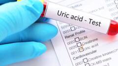 Uric Acid: ਯੂਰਿਕ ਐਸਿਡ ਵਧਣ ਤੋਂ ਪਹਿਲਾਂ ਸਰੀਰ 'ਚ ਨਜ਼ਰ ਆਉਂਦੇ ਆਹ ਲੱਛਣ, ਬਿਲਕੁਲ ਵੀ ਨਾ ਕਰੋ ਨਜ਼ਰਅੰਦਾਜ਼