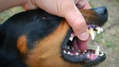 Dog Bite: કૂતરું કરડવાથી દર વર્ષે કેટલા લોકોના થાય છે મોત ?