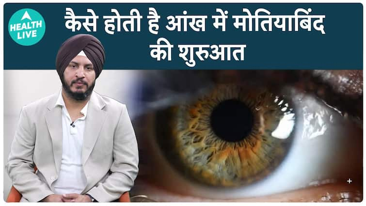 Cataract Month : मोतियाबिंद की कैसे होती है शुरुवात और कैसे होता है इसका इलाज | Health Live