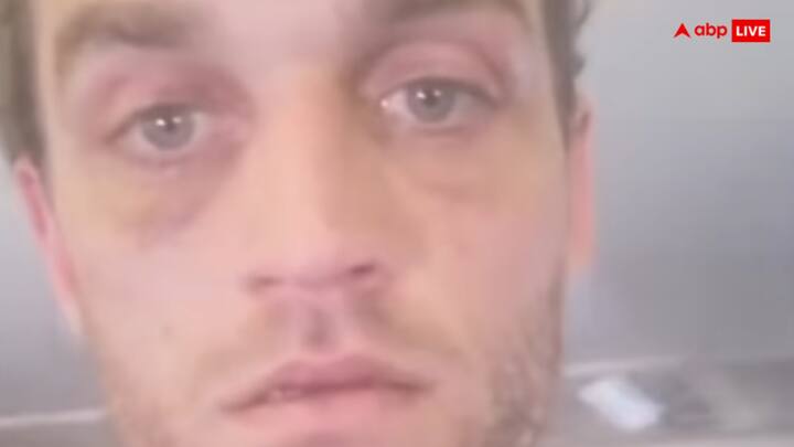 द मिरर की अगर मानें तो यात्रियों को प्लेन से बाहर निकलने और आगे के निर्देशों का इंतजार करने के लिए एथेंस इंटरनेशनल हवाई अड्डे की टर्मिनल बिल्डिंग में लौटने को कहा गया था.