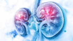 World Kidney Cancer Day: ప్రపంచ కిడ్నీ క్యాన్సర్ దినోత్సవం: ఈ జాగ్రత్తలు పాటిస్తే కిడ్నీలను సేఫ్ గా ఉంచుకోవచ్చు!