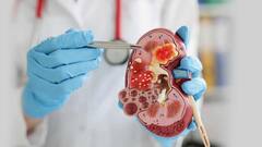 World Kidney Cancer Day: ప్రపంచ కిడ్నీ క్యాన్సర్ దినోత్సవం: ఈ జాగ్రత్తలు పాటిస్తే కిడ్నీలను సేఫ్ గా ఉంచుకోవచ్చు!