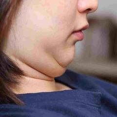 Perfect Look : ਕੀ ਤੁਸੀਂ ਵੀ ਡਬਲ ਚਿਨ ਤੋਂ ਪ੍ਰੇਸ਼ਾਨ ਤਾਂ ਇੰਝ ਕਰੋ ਸਮੱਸਿਆ ਦਾ ਹੱਲ