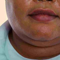 Perfect Look : ਕੀ ਤੁਸੀਂ ਵੀ ਡਬਲ ਚਿਨ ਤੋਂ ਪ੍ਰੇਸ਼ਾਨ ਤਾਂ ਇੰਝ ਕਰੋ ਸਮੱਸਿਆ ਦਾ ਹੱਲ