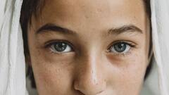 Puffy Eyes: ফুলছে চোখ! চটজলদি সমাধান কীভাবে?