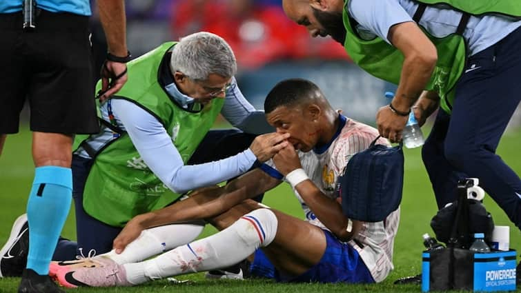 Euro 2024 Kylian Mbappe suffers nose injury in Frances win over Austria Euro 2024: ફ્રાન્સે પોતાની પ્રથમ મેચમાં ઓસ્ટ્રિયાને 1-0થી હરાવ્યું, કિલિયન એમ્બાપ્પેનું નાક તૂટ્યું