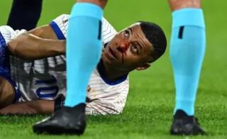 Euro 2024: ਕਪਤਾਨ ਕਿਲੀਅਨ ਐਮਬਾਪੇ ਦੀ ਟੁੱਟੀ ਨੱਕ, ਅਗਲੇ ਮੈਚਾਂ ਤੱਕ ਹੋਏ ਬਾਹਰ