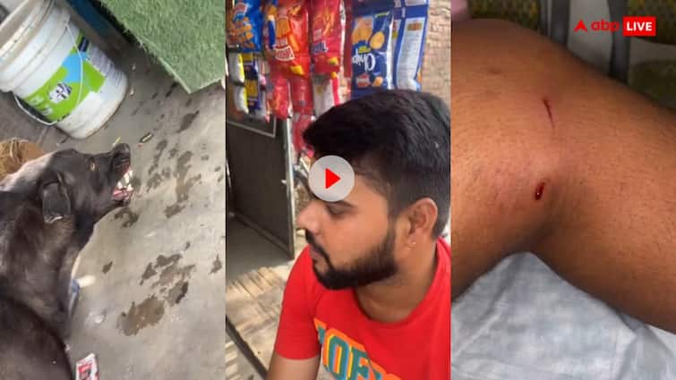 Man called the dog Kalu the dog bitten him video goes viral Video: 'कालू' बोलने पर बुरी तरह किलस गया कुत्ता, काट-काटकर किया लड़के का बुरा हाल, देखें वीडियो