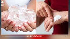 Health Care News: ਕੀ ਤੁਸੀਂ ਸੜੀ ਹੋਈ ਥਾਂ 'ਤੇ ਬਰਫ਼ ਜਾਂ ਕੋਲਗੇਟ ਲਗਾਉਂਦੇ ਹੋ? ਭੁੱਲ ਕੇ ਵੀ ਨਾ ਕਰੋ ਇਹ ਗਲਤੀ, ਨਹੀਂ ਤਾਂ...