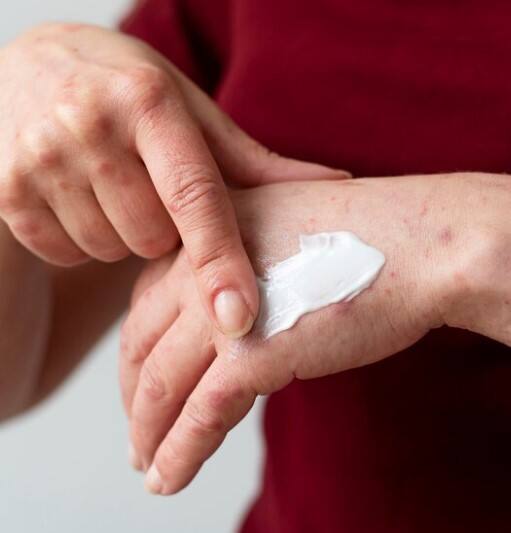 ਜਦੋਂ ਵੀ ਕਿਸੇ ਚੀਜ਼ ਦੇ ਨਾਲ ਸਕਿਨ ਸੜ ਜਾਂਦੀ ਹੈ ਤਾਂ ਅਸੀਂ ਸੋਚਦੇ ਹਾਂ ਕਿ ਠੰਡੀਆਂ ਚੀਜ਼ਾਂ ਲਗਾਉਣ ਨਾਲ ਛਾਲੇ ਬਣਨ ਤੋਂ ਰੋਕਦੇ ਹਨ। ਜਿਸ ਕਰਕੇ ਅਸੀਂ ਅਕਸਰ ਹੀ ਬਰਫ਼ ਜਾਂ ਕੋਲਗੇਟ ਦੀ ਵਰਤੋਂ ਕਰ ਲੈਂਦਾ ਹੈ।