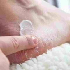 Cracked Heels : ਫਟੀਆਂ ਹੋਈਆਂ ਅੱਡੀਆਂ ਨੂੰ ਠੀਕ ਕਰਨ ਲਈ ਘਰ 'ਚ ਹੀ ਕਰੋ ਪੈਡੀਕਿਓਰ