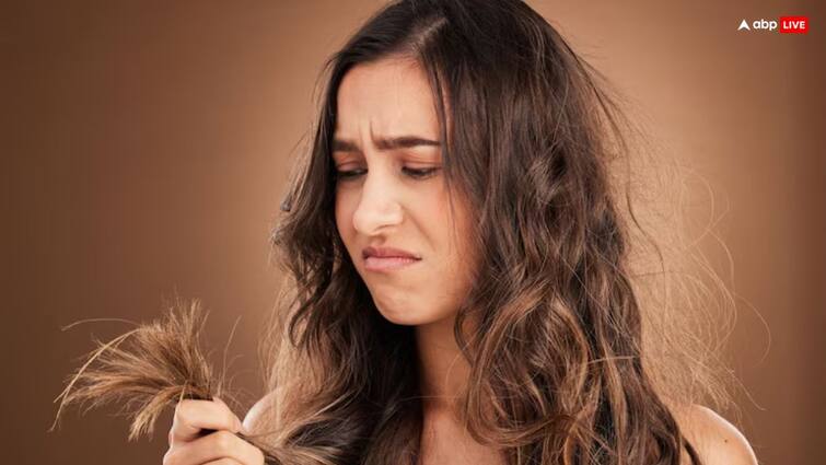 dry and rough hair care tips remove dandruff home remedies baalo ko banaye majboot Hair Care Tips: डैंड्रफ की वजह से आपके बाल भी हो गए हैं रूखे और बेजान, तो आजमाएं ये घरेलू उपाय