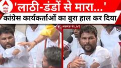 NEET Exam Controversy: Lucknow में प्रदर्शन कर रहे थे Congress कार्यकर्ता, फिर हो गया ये हाल !