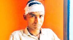 सैलून में बाल कटवा रहे पति ने नहीं उठाया फोन, नाराज बीवी ने घर पहुंचते ही ईंट मारकर फोड़ा सिर