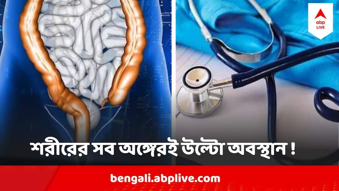 Nadia Medical News Patient With Organs In Opposite Side Operated In Nadia Hospital Nadia Medical News : রোগীর হার্ট থেকে বৃহদন্ত্র সবই উল্টোদিকে, জটিল অস্ত্রোপচার করে সাড়া ফেলল নদিয়ায় হাসপাতাল