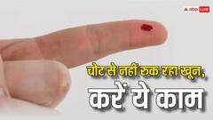 चोट लगने के बाद नहीं रुक रही खून की धार, तो ब्लीडिंग रोकने के लिए करें ये काम