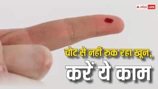 Health Risk: चोट लगने के बाद नहीं रुक रही खून की धार, तो ब्लीडिंग रोकने के लिए करें ये काम
