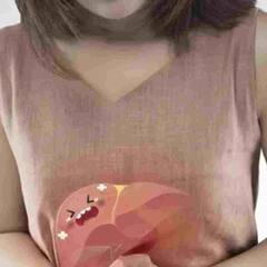 Fatty Liver : ਛੋਟੀ ਉਮਰ 'ਚ ਹੀ ਨੌਜਵਾਨ ਹੋ ਰਹੇ ਹਨ ਫੈਟੀ ਲਿਵਰ ਦੇ ਸ਼ਿਕਾਰ, ਜਾਣੋ ਕਾਰਣ ਤੇ ਇਸਦੇ ਲੱਛਣ