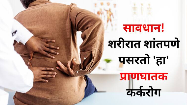 Health lifestyle marathi news Beware kidney cancer spreads quietly in the body know symptom from doctors Health : सावधान! शरीरात शांतपणे पसरतो 'हा' प्राणघातक कर्करोग, 'ही' लक्षणं सहज दिसून येत नाहीत, डॉक्टर सांगतात...