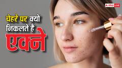 3,000 साल पुरानी पद्धति से करें चेहरे का इलाज, मुंहासों से मिलेगा झटपट निजात