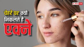 Face Mapping: 3,000 साल पुरानी पद्धति से करें चेहरे का इलाज, मुंहासों से मिलेगा झटपट निजात