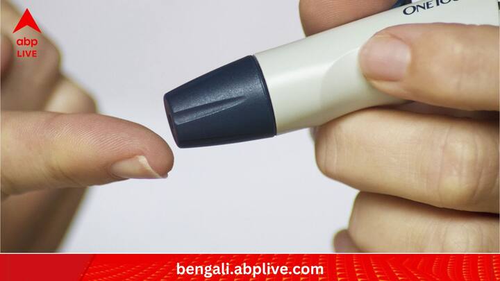 ভিটামিন সি, ক্যারোটিনয়েডস এবং ফ্ল্যাভোনয়েডস-সমৃদ্ধ চালকুমড়ো আমাদের দেহকোষকে একাধিক ক্ষয় থেকে রক্ষা করে। পাশাপাশি টাইপ টু ডায়াবিটিস আটকাতেও এর জরুরি ভূমিকা রয়েছে। (ছবি:PIXABAY)