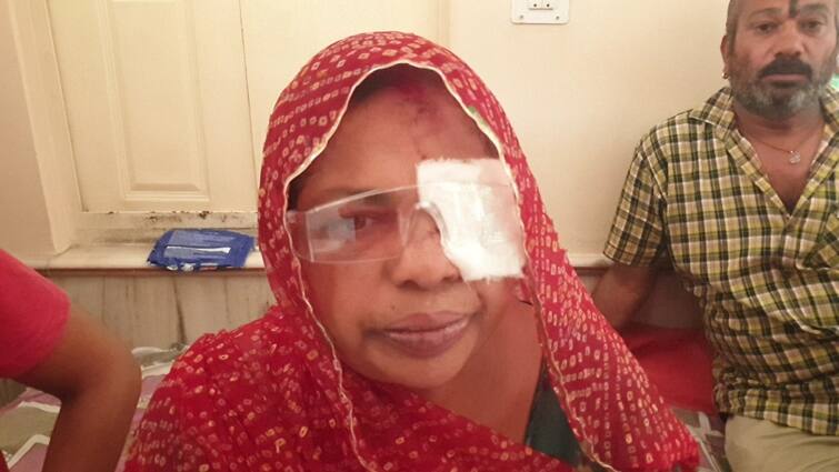 Jodhpur sursagar Violence woman eye burst People demand bulldozer action like UP ANN Jodhpur Violence: सूरसागर हिंसा में फूटी महिला की आंख, बोलीं- 'मेरा क्या कसूर था जो...'