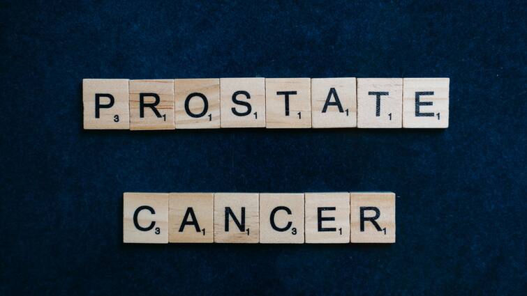 Prostate Cancer Vital Information Every Man Must Know