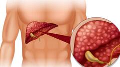 फैटी लिवर होने पर दिखते हैं ये लक्षण, चुपके से खराब करने लगती है सेहत...ऐसे करें कंट्रोल