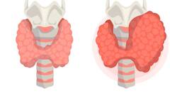 Thyroid Symptoms: थायरॉइड बढ़ने पर शरीर में होते हैं यह खतरनाक बदलाव, ऐसे कर सकते हैं कंट्रोल