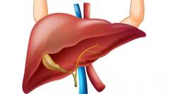 Health: ਫੈਟੀ ਲੀਵਰ ਹੋਣ ਤੋਂ ਪਹਿਲਾਂ ਸਰੀਰ 'ਚ ਨਜ਼ਰ ਆਉਂਦੇ ਆਹ ਲੱਛਣ, ਅਚਾਨਕ ਸਿਹਤ ਹੁੰਦੀ ਖਰਾਬ