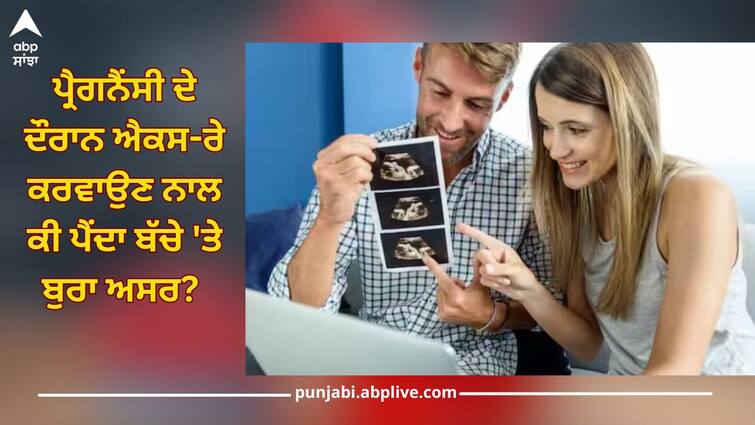 x ray during pregnancy is it safe to children full details so read this X-rays Harmful During Pregnancy: ਪ੍ਰੈਗਨੈਂਸੀ ਦੇ ਦੌਰਾਨ ਐਕਸ-ਰੇ ਕਰਵਾਉਣ ਨਾਲ ਕੀ ਪੈਂਦਾ ਬੱਚੇ 'ਤੇ ਬੁਰਾ ਅਸਰ? ਜਾਣੋ ਕੀ ਹੈ ਸੱਚ!