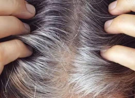 white Hair turn black naturally home remedies  નાની ઉંમરમાં જ સફેદ થઈ જતા વાળ કાળા કરવાનો ઘરગથ્થુ ઉપાય, આજે જ કરો ટ્રાય