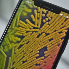 Mobile Bacteria: જમતી વખતે ફોન સ્વીચ ઓફ કરી દો, નહીંતર શરીરમાં અનેક ખતરનાક બીમારીઓ ઘર કરી જશે