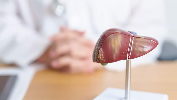 Non-Alcoholic Fatty Liver Disease (NAFLD) is a silent epidemic, usually having no clinical symptoms unless the disease is far advanced. The spectrum of the disease ranges from simple deposition of fat in the liver to derangement of LFT and further progression into fibrosis, cirrhosis, HCC, and mortality due to liver dysfunction, major adverse cardiovascular events, or neurological disorders.(Image source: Canva)