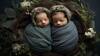 Twins Birth: IVF से बढ़ जाती है जुड़वा बच्चे होने की संभावना, एक्सपर्ट्स से जानें आखिर क्या है इसके पीछे की वजह
