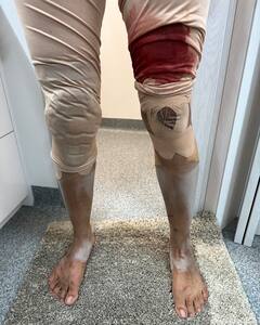 Priyanka Chopra Injury: 'द ब्लफ' की शूटिंग में बुरी तरह घायल हुईं प्रियंका चोपड़ा, फिर पैरों में करवाई लहसुन की मालिश, देखें तस्वीरें