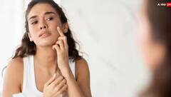 Beauty Tips: ਪੀਰੀਅਡਸ ਦੌਰਾਨ ਤੁਹਾਡੇ ਚਿਹਰੇ 'ਤੇ ਵੀ ਹੁੰਦੇ ਪਿੰਪਲਸ, ਤਾਂ ਇਸ ਤਰੀਕੇ ਨਾਲ ਪਾਓ ਛੁਟਕਾਰਾ