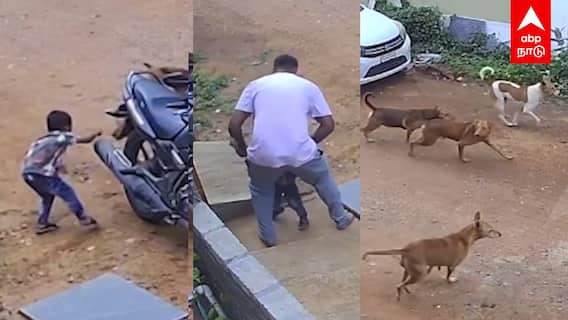 Dog Attack Boy | மகனை சுத்துப்போட்ட நாய்கள் நொடியில் காப்பாற்றிய தந்தை பதற வைக்கும் வீடியோ