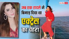 जब टीवी की 'कुसुम' का एक हादसे ने बिगाड़ दिया था चेहरा, एक्ट्रेस को पहचानना भी हुआ मुश्किल