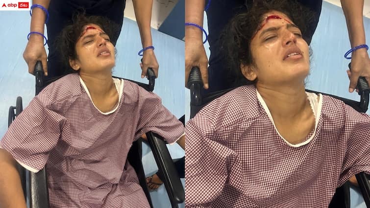 pg student was injured after a fan fell in the hostel room of Kakatiya University Kakatiya University: హాస్టల్ గదిలో ఊడిపడిన ఫ్యాన్ - విద్యార్థిని తలకు తీవ్ర గాయం, విద్యార్థుల ఆందోళన